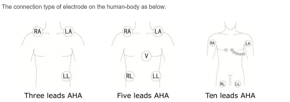 5-провідні електропроводи ЕКГ для Philips digitrak плюс цілодобовий холтер 3100A, 5-провідний, Snap