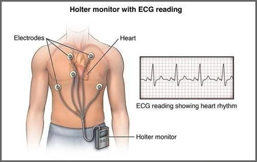 Medical 55mm Round Disposable ECG Electrode suppliers